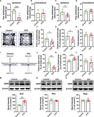 Activation of GIPR Exerts Analgesic and Anxiolytic-Like Effects in the Anterior Cingulate Cortex of Mice